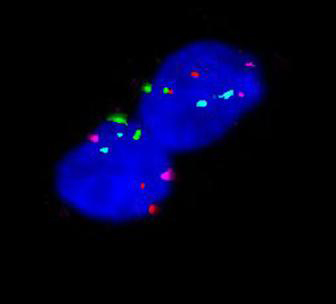 Neues KfH-Nierenzentrum in Jena 