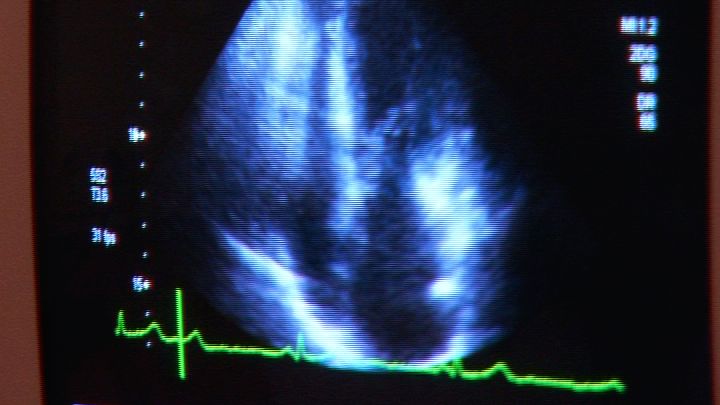 Seminar zum „schwachen Herzen“ am 8. November