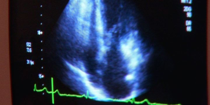 Seminar zum „schwachen Herzen“ am 8. November