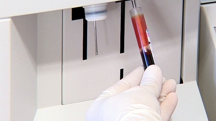 Medizin-Daten im Verbund besser nutzen 