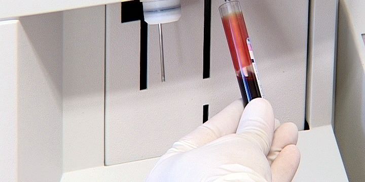 Medizin-Daten im Verbund besser nutzen 