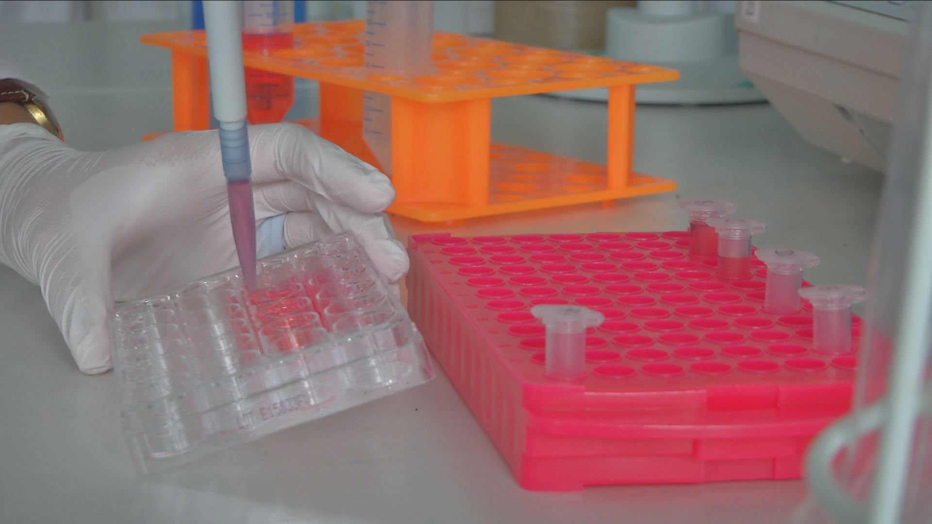 Probandinnen für Cholesterin-Studie gesucht 