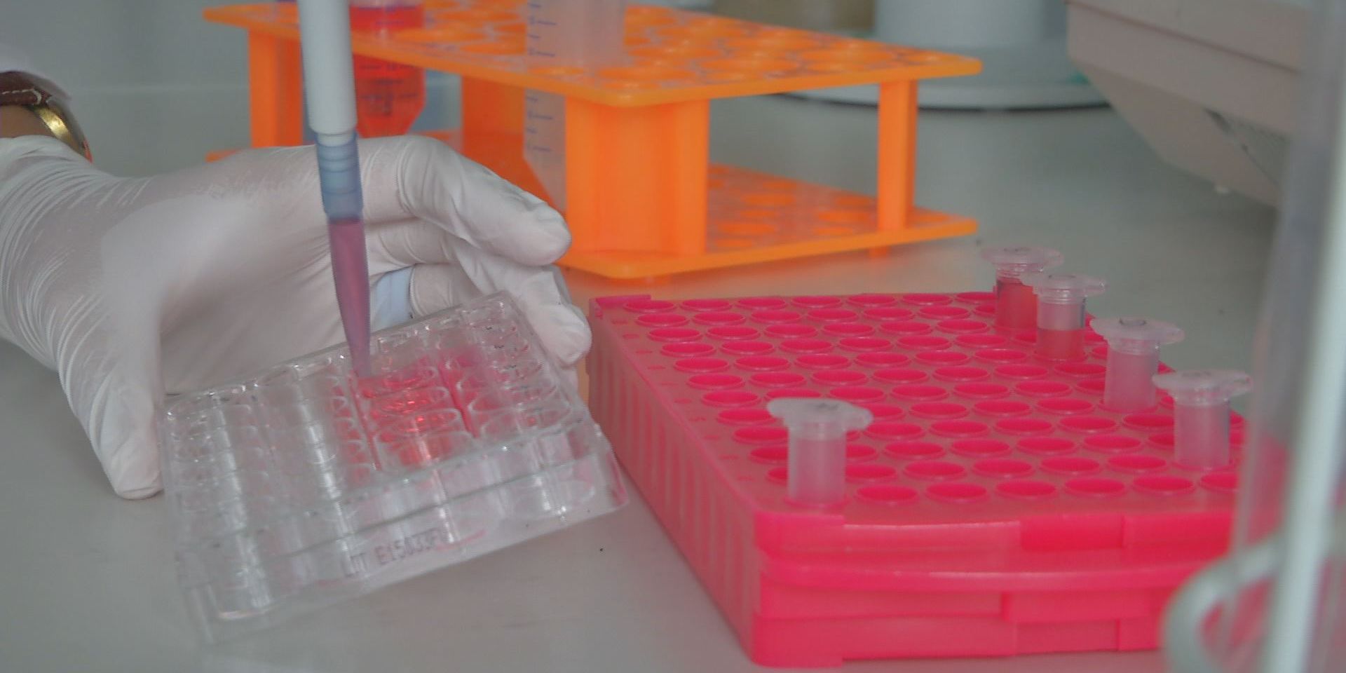 Probandinnen für Cholesterin-Studie gesucht 