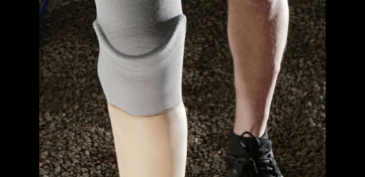 Bessere Prothesen – weniger Schmerz