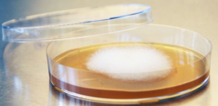 Tödliche Pilzinfektionen: Jenaer und Kölner Wissenschaftler kooperieren