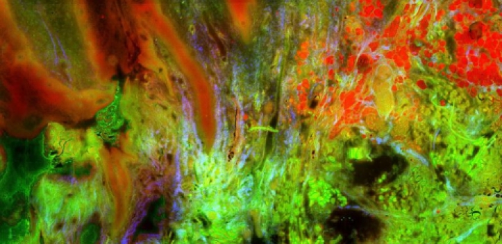 Bildgebendes Endoskopieverfahren als Fenster zum Gehirn