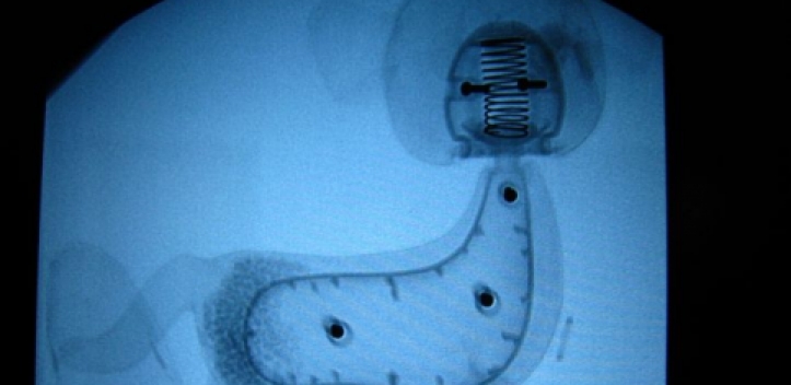 „Kuscheltierröntgen“ am Uni-Klinikum
