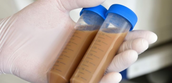 Erste Erfolge bei Therapie von Dickdarmentzündung