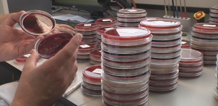 Welt-Sepsis-Tag am Universitätsklinikum