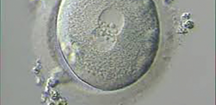 Erste künstliche Befruchtung im neuen IVF-Labor am UKJ