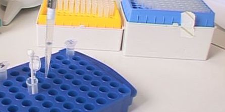 Antibiotika-Entwicklung: Akademische Forschung sucht nach Lösungen