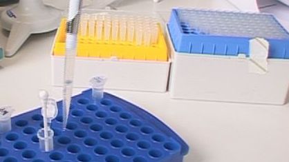 Antibiotika-Entwicklung: Akademische Forschung sucht nach Lösungen