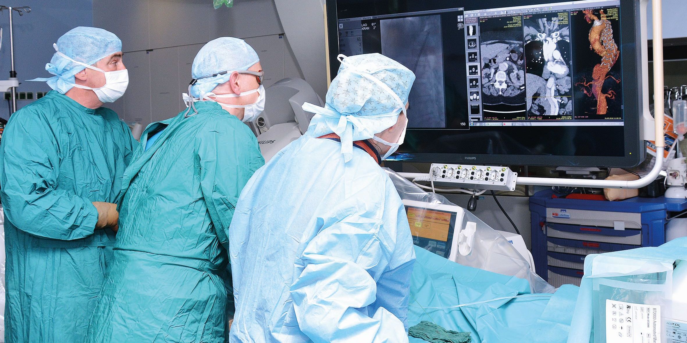 Gefährliche Beule der Bauchschlagader