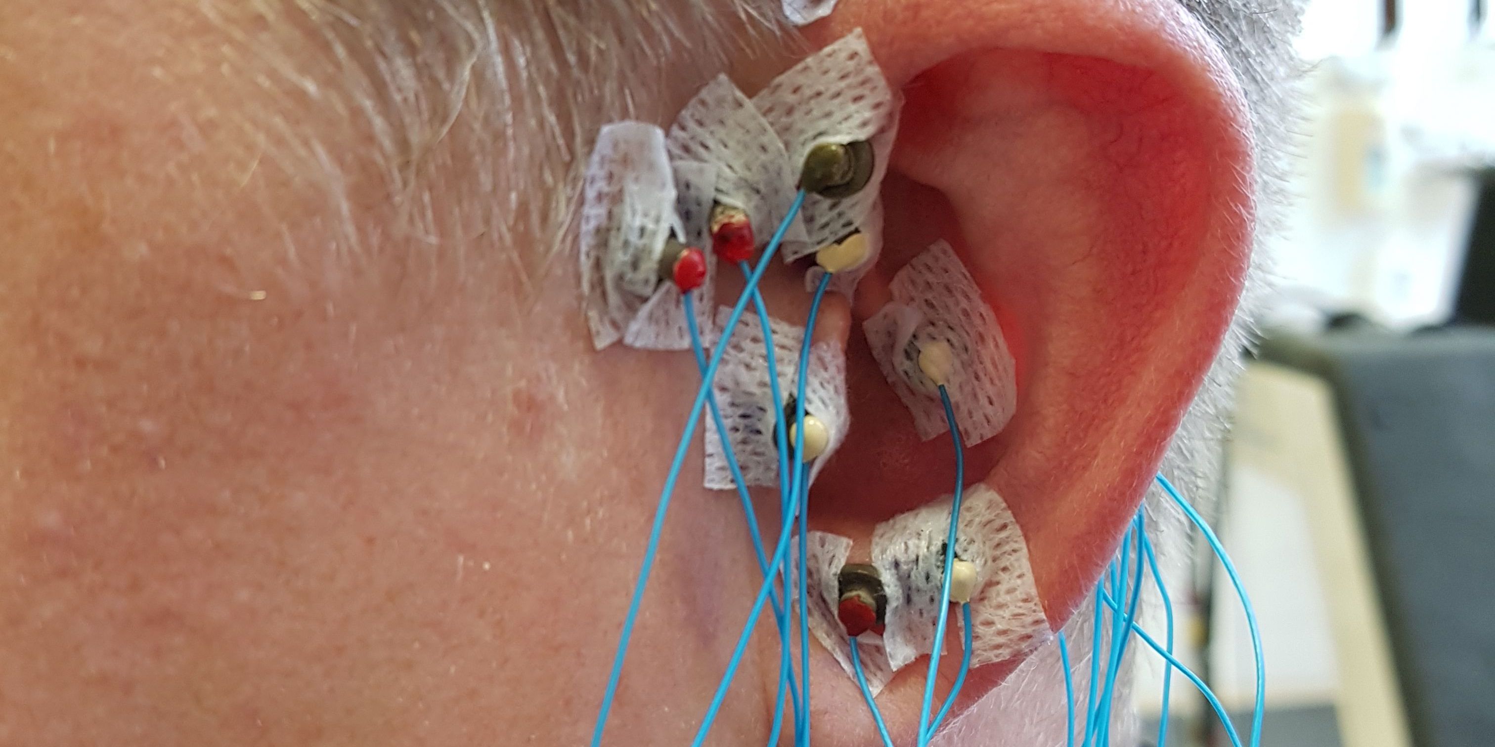 Studie: Wer kann mit den Ohren wackeln? Studie: Wer kann mit den Ohren wackeln?