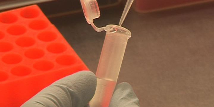 Sepsis: Bilder einer wenig bekannten Erkrankung 