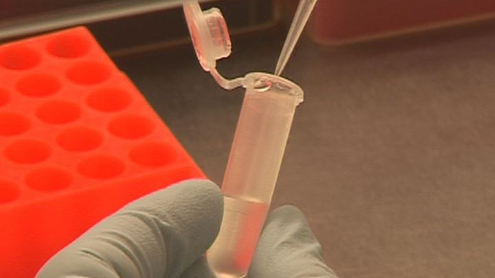 Zweiter „World Sepsis Congress“ 