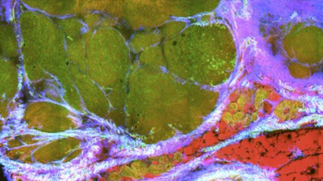 Jenaer Forscherteam für Preis nominiert