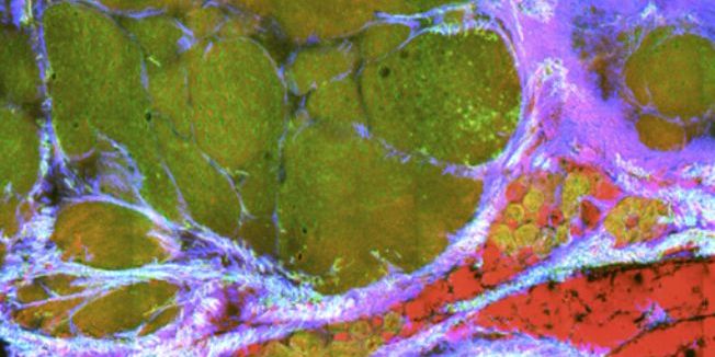 Jenaer Forscherteam für Preis nominiert