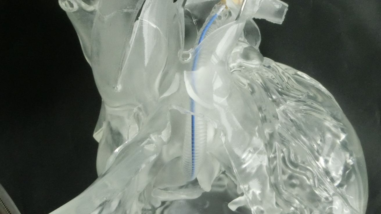 Pumpsystem zur Herzunterstützung entwickelt