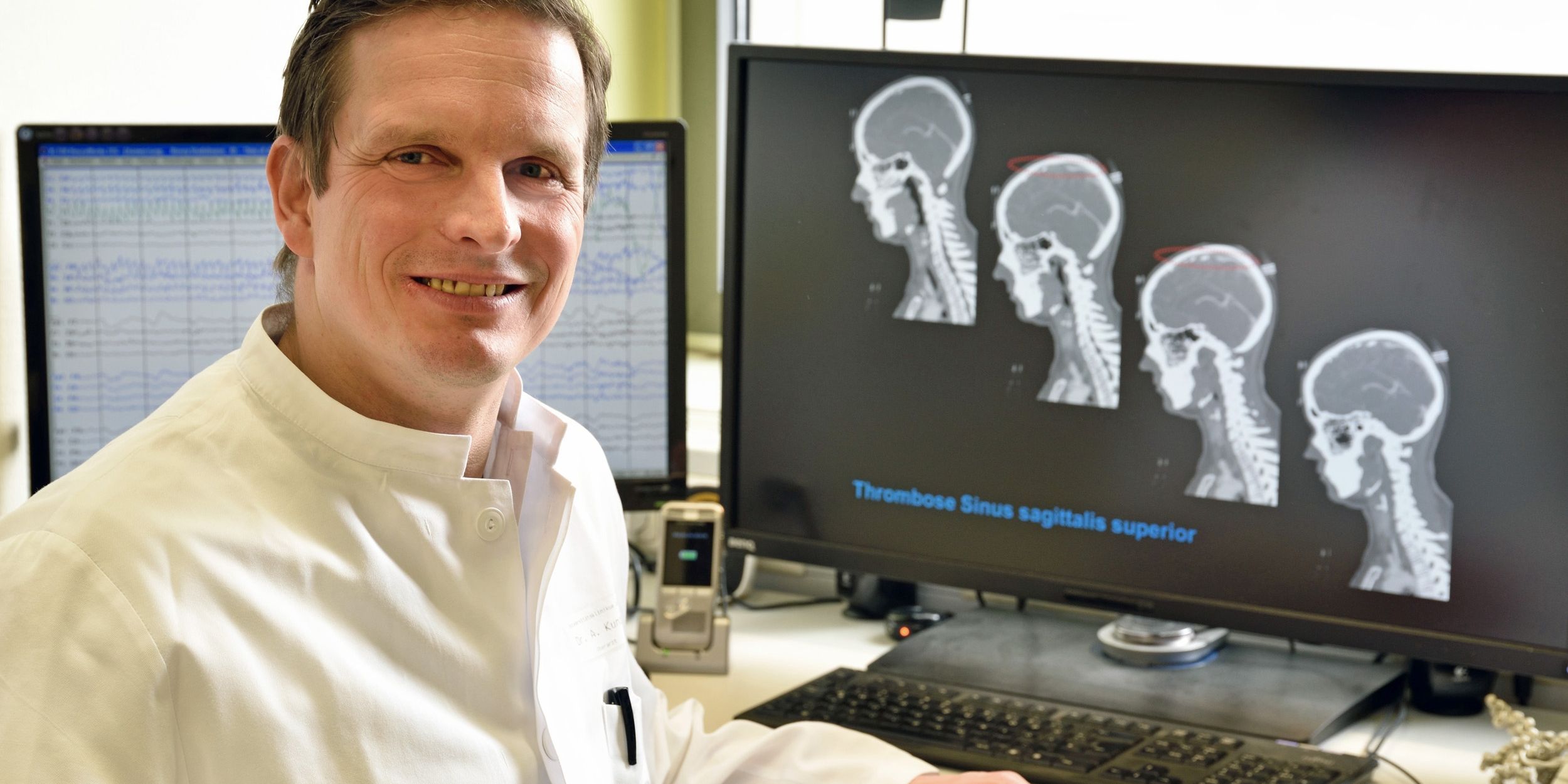 Höchste Qualität bei Behandlung von Epilepsie Höchste Qualität bei Behandlung von Epilepsie