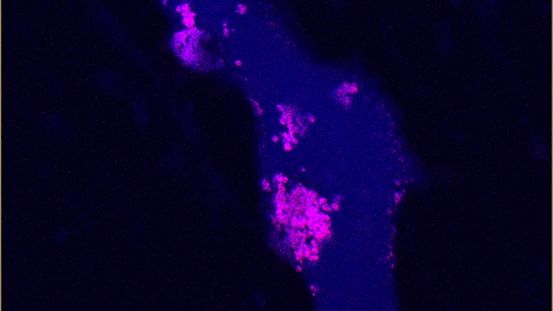 Körpereigenes Protein reduziert Einlagerungen in Adern