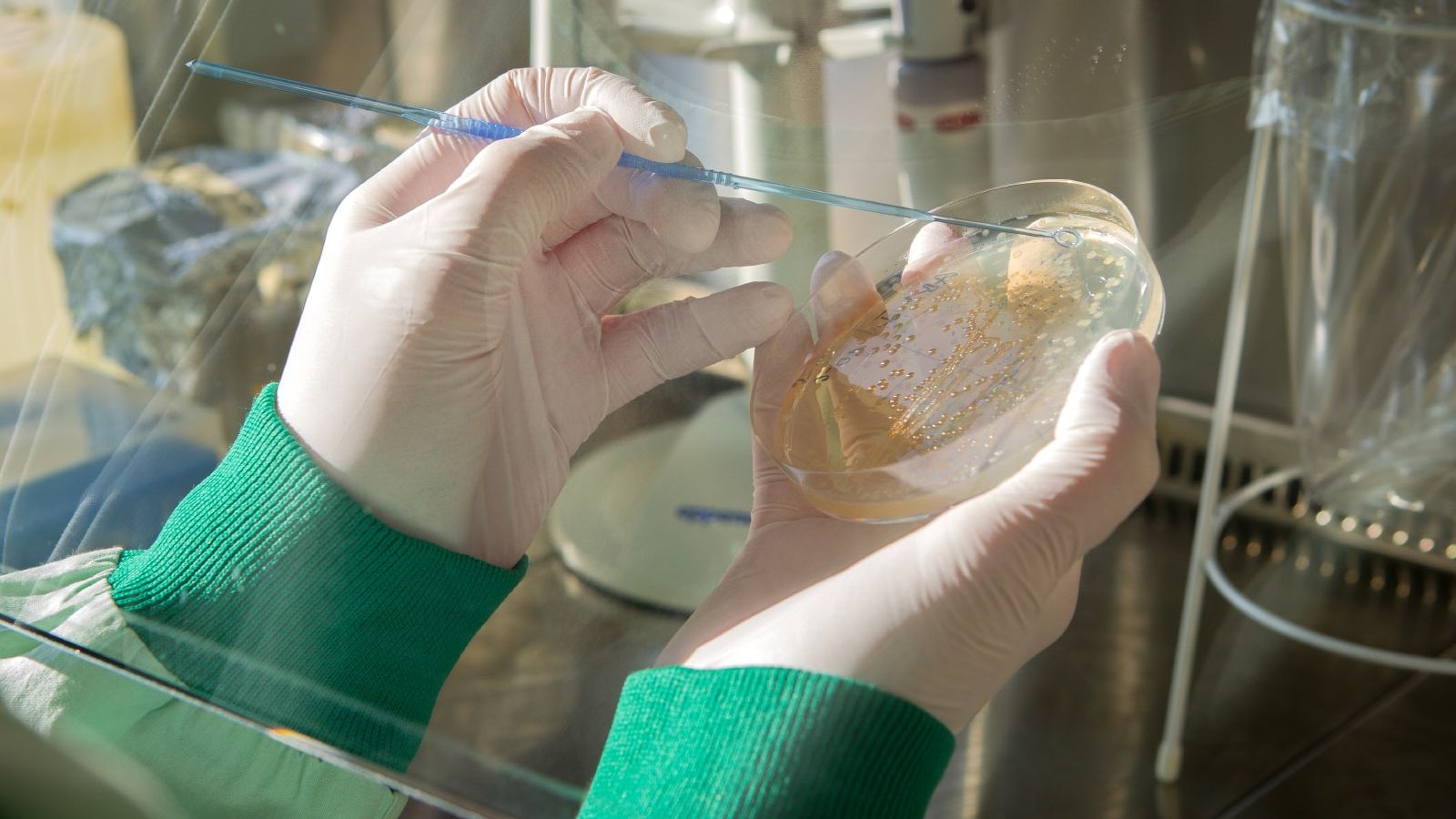 Studie zu Krankenhausinfektionen: Patienten bringen hochresistente Keime in die Klinik  