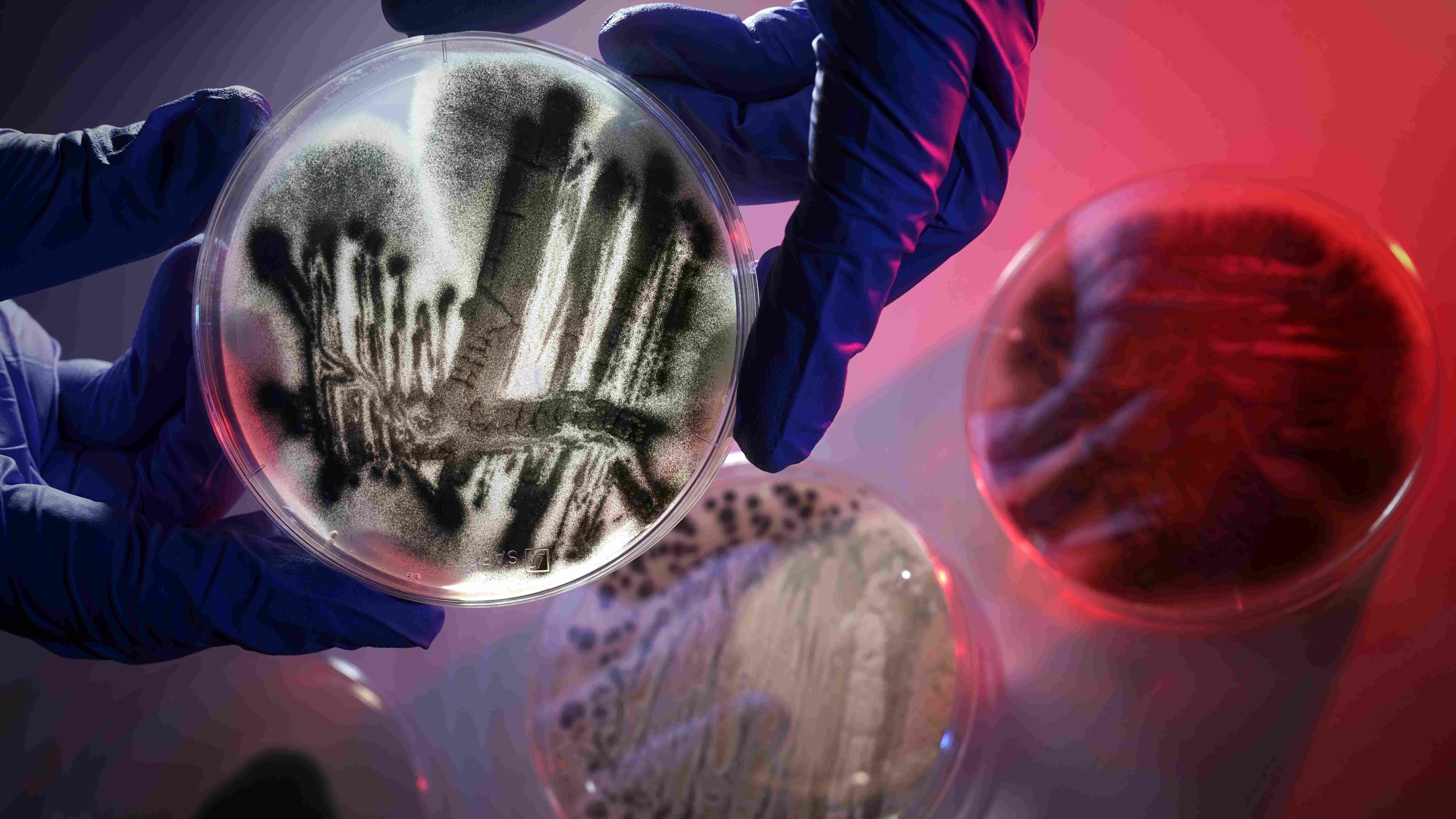 Wie ein Schimmelpilz das Immunsystem lahmlegt