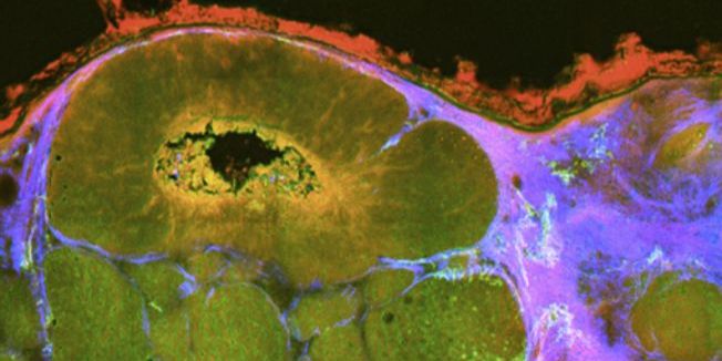 Krebs-Forscherteam auf Photonik-Messe