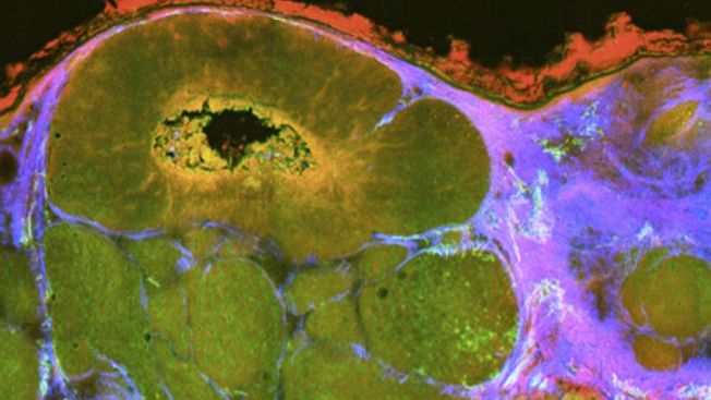 Krebs-Forscherteam auf Photonik-Messe